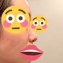小鼻縮小（切開） / 小鼻縮小（非切開） Taide Suenaga Clinic（タイデスエナガクリニック） DAY 29 サムネイル用