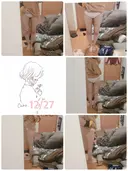 脂肪吸引（脚） / 脂肪吸引（お尻） ヨンセスリムライン DAY 77 サムネイル用