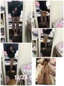 脂肪吸引（脚） / 脂肪吸引（お尻） ヨンセスリムライン DAY 73 サムネイル用
