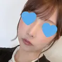 隆鼻術 / 鼻尖形成（切開） / 鼻中隔延長（切開） / 軟骨移植 / 骨切幅寄せ / 真皮移植 Zetith Beauty Clinic 銀座院 DAY 285 サムネイル用