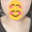 ボトックス（エラ・小顔） TCB東京中央美容外科 高崎院 DAY 4 サムネイル用