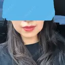 ボトックス（エラ・小顔） / 脂肪溶解注射（顔） あいちビューティークリニック DAY 0 サムネイル用