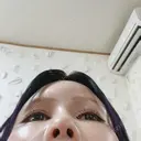 鼻尖形成（非切開） / 鼻中隔延長（非切開） ルラ美容クリニック銀座院 DAY 3 サムネイル用
