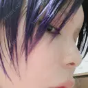 鼻尖形成（非切開） / 鼻中隔延長（非切開） ルラ美容クリニック銀座院 DAY 7 サムネイル用