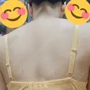医療脱毛（背中） 渋谷美容外科クリニック 渋谷院 DAY 1 サムネイル用
