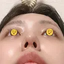 鼻尖形成（切開） / 軟骨移植 / ヒアルロン酸注入（涙袋） / ヒアルロン酸注入（唇） / ボトックス（口角） / ヒアルロン酸注入（額） 東京シンデレラ美容外科 池袋院 DAY 27 サムネイル用