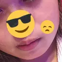 ボトックス（エラ・小顔） STARS CLINIC DAY 6 サムネイル用