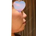 鼻尖形成（切開） Olino美容外科・美容皮膚科 DAY 49 サムネイル用