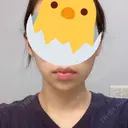 ボトックス（あご） / ヒアルロン酸注入（あご） フローラクリニック DAY 1 サムネイル用
