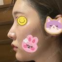 隆鼻術 / 鼻尖形成（切開） / 鼻中隔延長（切開） / 小鼻縮小（切開） / プロテーゼ除去 / 鼻尖縮小 FROM B整形外科 (旧バウム整形外科) AFTER サムネイル用