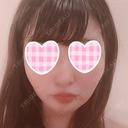 バッカルファット除去 / 脂肪吸引（顔） / ボトックス（あご） / ヒアルロン酸注入（あご） / ボトックス（エラ・小顔） / ヒアルロン酸注入（唇） / ボトックス（口角） エートップ美容整形外科 DAY 55 サムネイル用