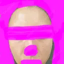 額を丸く / その他（輪郭） クリニックビューティー恵比寿 AFTER サムネイル用