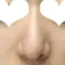 鼻尖形成（切開） / 鼻中隔延長（切開） / 小鼻縮小（切開） / 軟骨移植 / 骨切幅寄せ リラ・クラニオフェイシャル・クリニック AFTER サムネイル用