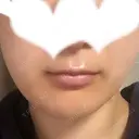 その他（輪郭） リラ・クラニオフェイシャル・クリニック DAY 553 サムネイル用