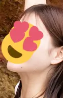 糸リフト / 脂肪吸引（顔） 湘南美容クリニック 大阪心斎橋院 DAY 520 サムネイル用