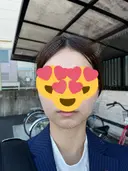 糸リフト / 脂肪吸引（顔） 湘南美容クリニック 大阪心斎橋院 DAY 520 サムネイル用