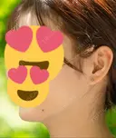 糸リフト / 脂肪吸引（顔） 湘南美容クリニック 大阪心斎橋院 AFTER サムネイル用