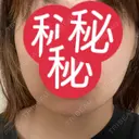 その他（輪郭） / 医療痩身（顔） WOM CLINIC GINZA （ワム クリニック ギンザ） DAY 172 サムネイル用
