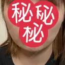 その他（輪郭） / 医療痩身（顔） WOM CLINIC GINZA （ワム クリニック ギンザ） DAY 174 サムネイル用