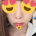 人中短縮 心斎橋中央クリニック DAY 14 サムネイル用