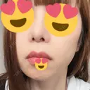 人中短縮 心斎橋中央クリニック DAY 14 サムネイル用