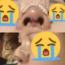 鼻中隔延長（切開） / 鼻尖縮小 ビスポーククリニック 福岡院 DAY 3 サムネイル用