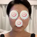 脂肪溶解注射（顔） 聖心美容クリニック 福岡院 DAY 1 サムネイル用
