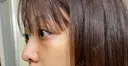 軟骨移植 フェアクリニック川口 DAY 7 サムネイル用