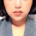ヒアルロン酸注入（唇） / ボトックス（口角） ルラ美容クリニック 名古屋本院 AFTER サムネイル用