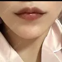 ボトックス（あご） / ヒアルロン酸注入（唇） / ボトックス（口角） ルラ美容クリニック 名古屋本院 AFTER サムネイル用