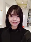ルフォー+ssro（両あご) リッツ美容外科 東京院 DAY 25 サムネイル用