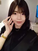 ルフォー+ssro（両あご) リッツ美容外科 東京院 DAY 25 サムネイル用