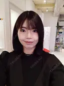 ルフォー+ssro（両あご) リッツ美容外科 東京院 DAY 25 サムネイル用