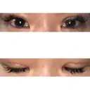 眼瞼下垂（切開） ピュア形成外科医院 DAY 15 サムネイル用