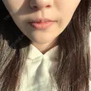 その他（輪郭） / ボトックス（エラ・小顔） TCB東京中央美容外科 堺院 DAY 4 サムネイル用