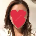 バッカルファット除去 / 脂肪吸引（顔） / 額を丸く / ヒアルロン酸注入（あご） / ボトックス（エラ・小顔） / ヒアルロン酸注入（額） エートップ美容整形外科 DAY 20 サムネイル用