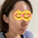 ヴェルヴェットスキン 新宿西口TAKUMI美容クリニック（シンジュクニシグチタクミビヨウクリニック) DAY 0 サムネイル用
