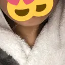 ボトックス（エラ・小顔） STARS CLINIC AFTER サムネイル用