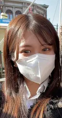 二重埋没 ASTRA BEAUTY CLINIC AFTER サムネイル用