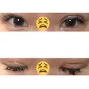 眼瞼下垂（切開） ピュア形成外科医院 DAY 16 サムネイル用