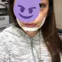 あごプロテーゼ 湘南美容クリニック 池袋西口院 DAY 3 サムネイル用