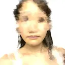 骨切り（あご） / 脂肪吸引（顔） 銀座マイアミ美容外科 DAY 87 サムネイル用