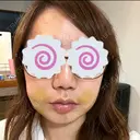 糸リフト / ジョールファット除去 ルラ美容クリニック 大阪本院 DAY 3 サムネイル用