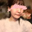 骨切り（あご） / 脂肪吸引（顔） 銀座マイアミ美容外科 DAY 90 サムネイル用