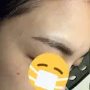 アートメイク（眉） TRUE DESIGN CLINIC DAY 0 サムネイル用