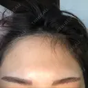 アートメイク（眉） TRUE DESIGN CLINIC DAY 1 サムネイル用