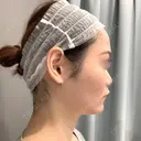糸リフト / バッカルファット除去 / 脂肪吸引（顔） / ボトックス（あご） / ヒアルロン酸注入（あご） / ボトックス（エラ・小顔） / ヒアルロン酸注入（唇） / その他（口元） アリエル美容クリニック 大宮院 DAY 92 サムネイル用
