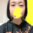 下まぶたたるみ取り / ヒアルロン酸注入（あご） / ボトックス（エラ・小顔） コスメディカルクリニック シンシア 銀座院 DAY 1 サムネイル用