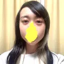 下まぶたたるみ取り / ヒアルロン酸注入（あご） / ボトックス（エラ・小顔） コスメディカルクリニック シンシア 銀座院 DAY 2 サムネイル用