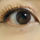 アートメイク（ほくろ） oneUPclinic AFTER サムネイル用